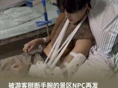 景区NPC和游客猜拳全程无人赢走银票 掰手腕致伤纠纷[推荐]