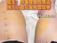男子抠脚不洗手右腿肿成猪蹄 200斤男子爱抠脚染上丹毒[推荐]