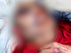 89岁老人与智力障碍室友互殴致骨折，多方回应[推荐]