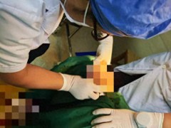 35岁男性遭眼镜蛇咬伤竟用嘴吸吮毒素，引发急危重症[推荐]